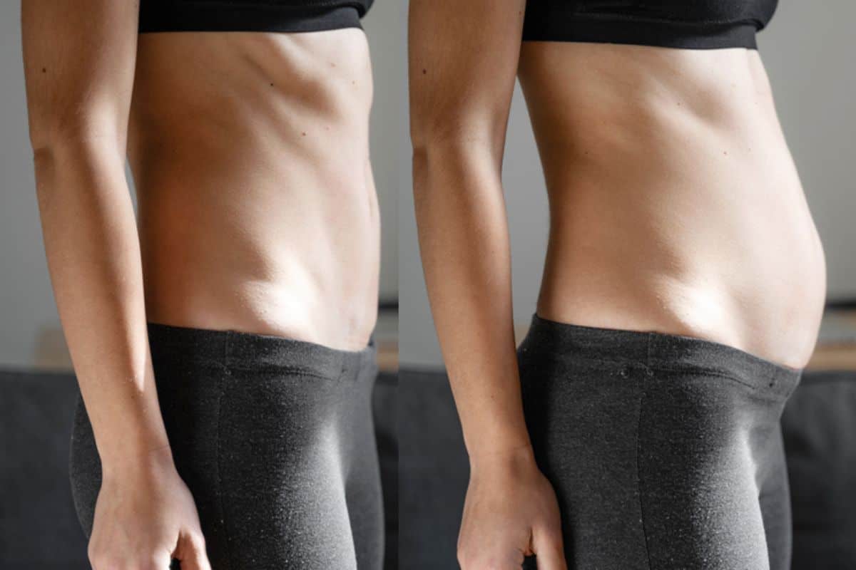 How long does diastasis recti take to improve Upper Sydenham?