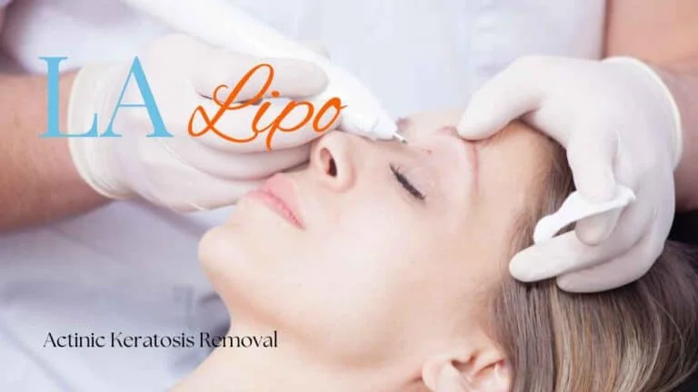 Woman receiving Actinic Keratosis Removal Treatment Upper Sydenham
