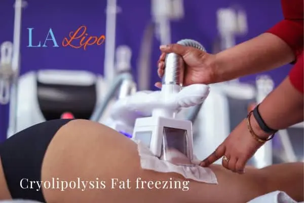 women getting fat freezing Upper Sydenham