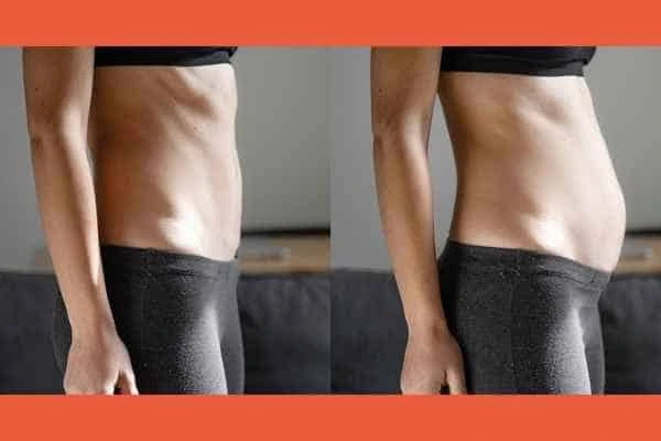 LA-EMS Body Sculpting results Upper Sydenham