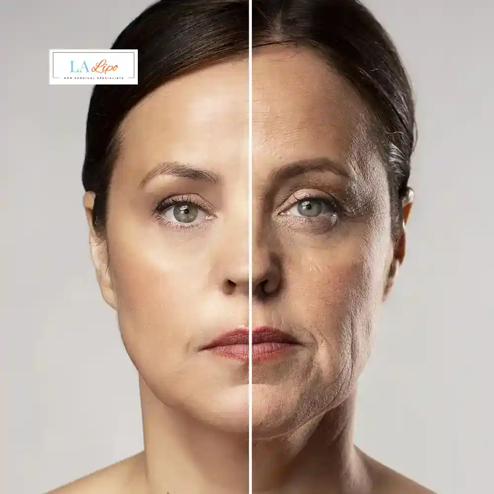 How Can You Tell If Non-Surgical Skin Tightening Is Right for You Upper Sydenham?